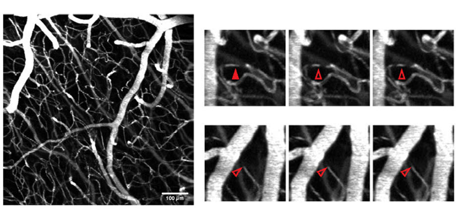 Bessel beam two-photon microscopy