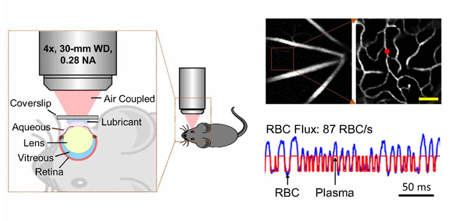 a two-photon microscope quantifies the flux of RBCs in microscopic capillaries within the retina