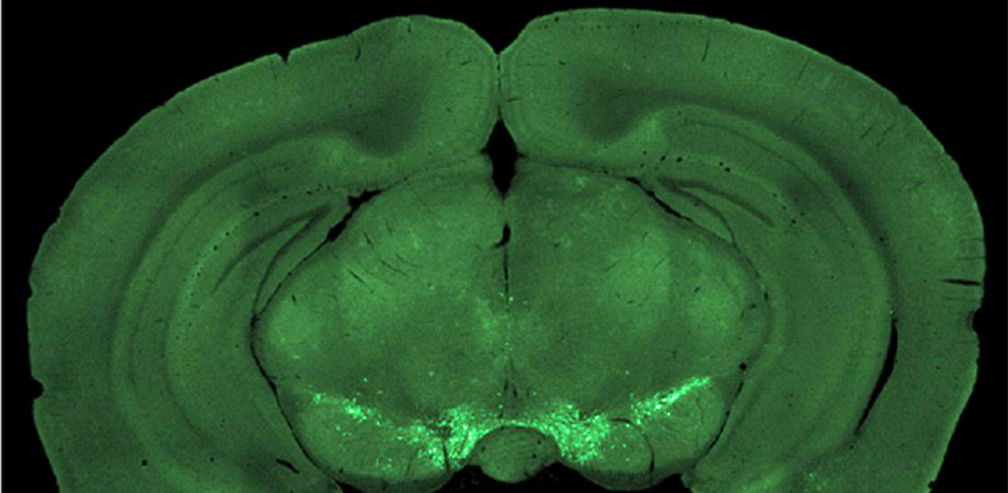 Two-photon microscopy helps researchers to observe mesocortical axon terminals