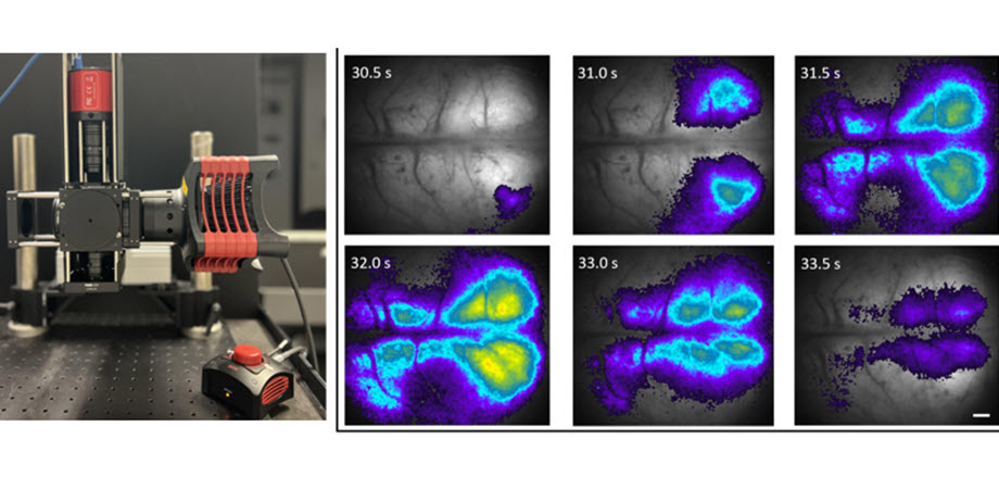 This newly developed modular mesoscope can be used for in vivo fluorescence imaging of rodent brains