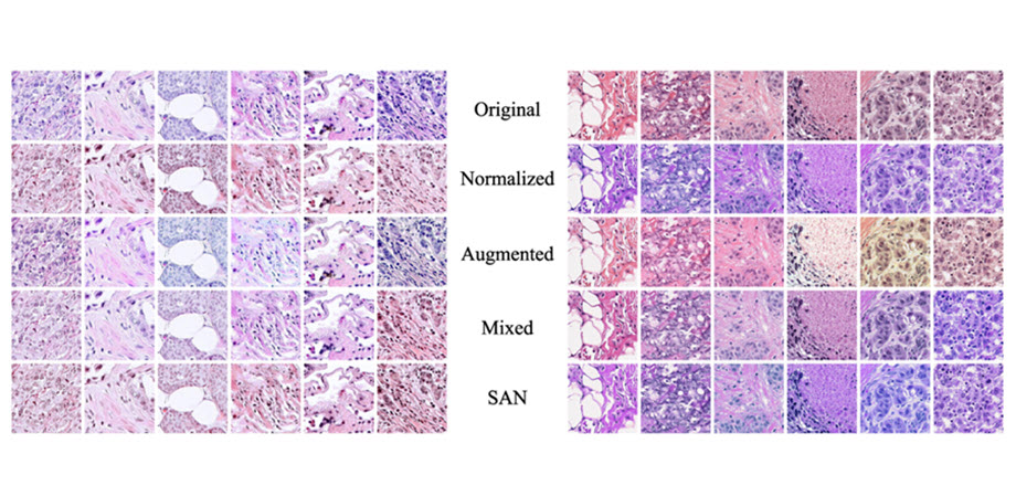 Tissue image datasets processed by stained SAN (bottom row) achieve color distributions that are more consistent than those processed using other techniques