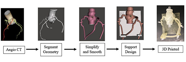 Five key steps in phantom design process