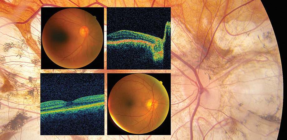 Automating care: How photonics and AI are changing medicine