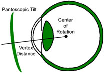 Pantoscopic Tilt